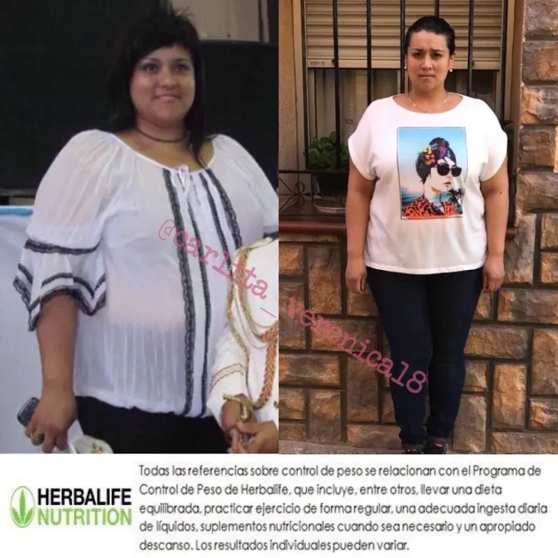 Antes y después con Herbalife 11 antes y despues 3